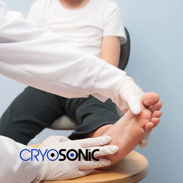 Are you looking for fast effective wart removal Contact us today Corby